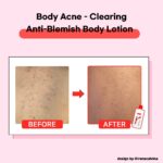 TIAM Anti Blemish Body Lotion 200 ml